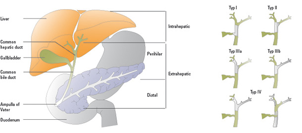 Biliary_Tract_Cancer_Types